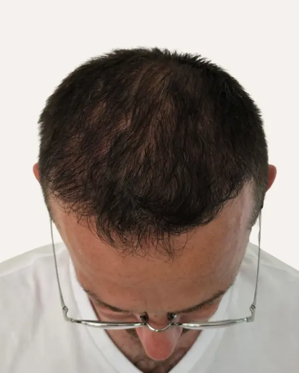  after